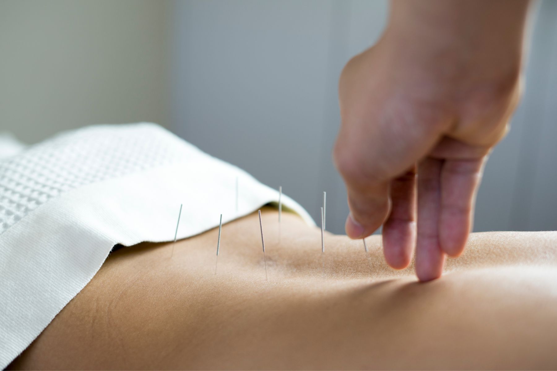 Acupuncture10
